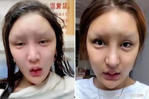 网红整容失败照片,美丽陷阱下的惊悚真相